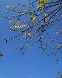 屈光不正是什么